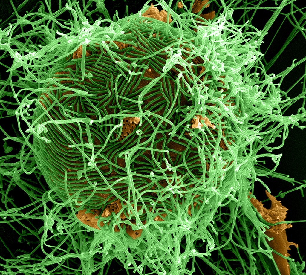 Scanning electron micrograph of Ebola virus particles: National Institute of Allergy and Infectious Diseases (NIAID) - Flickr